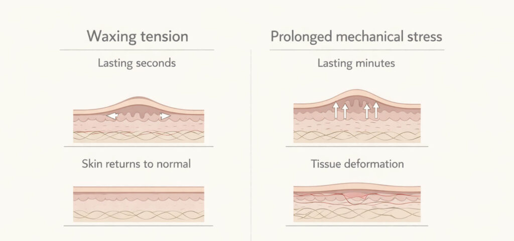 แผนภาพแสดงการดึงผิวชั่วคราวระหว่างการแว็กซ์ เทียบกับการยืดผิวในระยะยาว